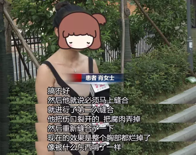 女子花近十万做丰胸手术 术后胸部溃烂似被啃